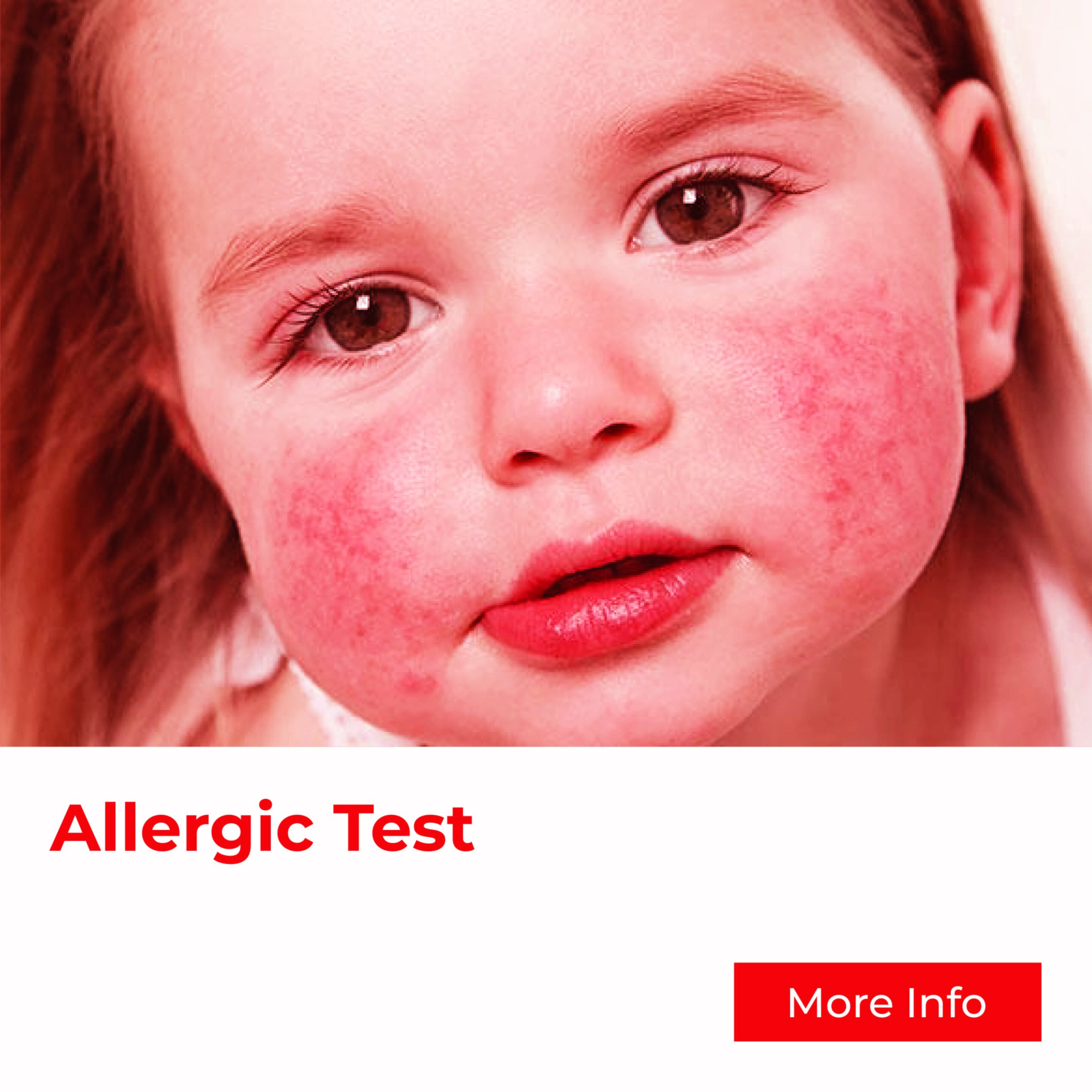 Infant or baby Allergic Test service by Klinik As Salam