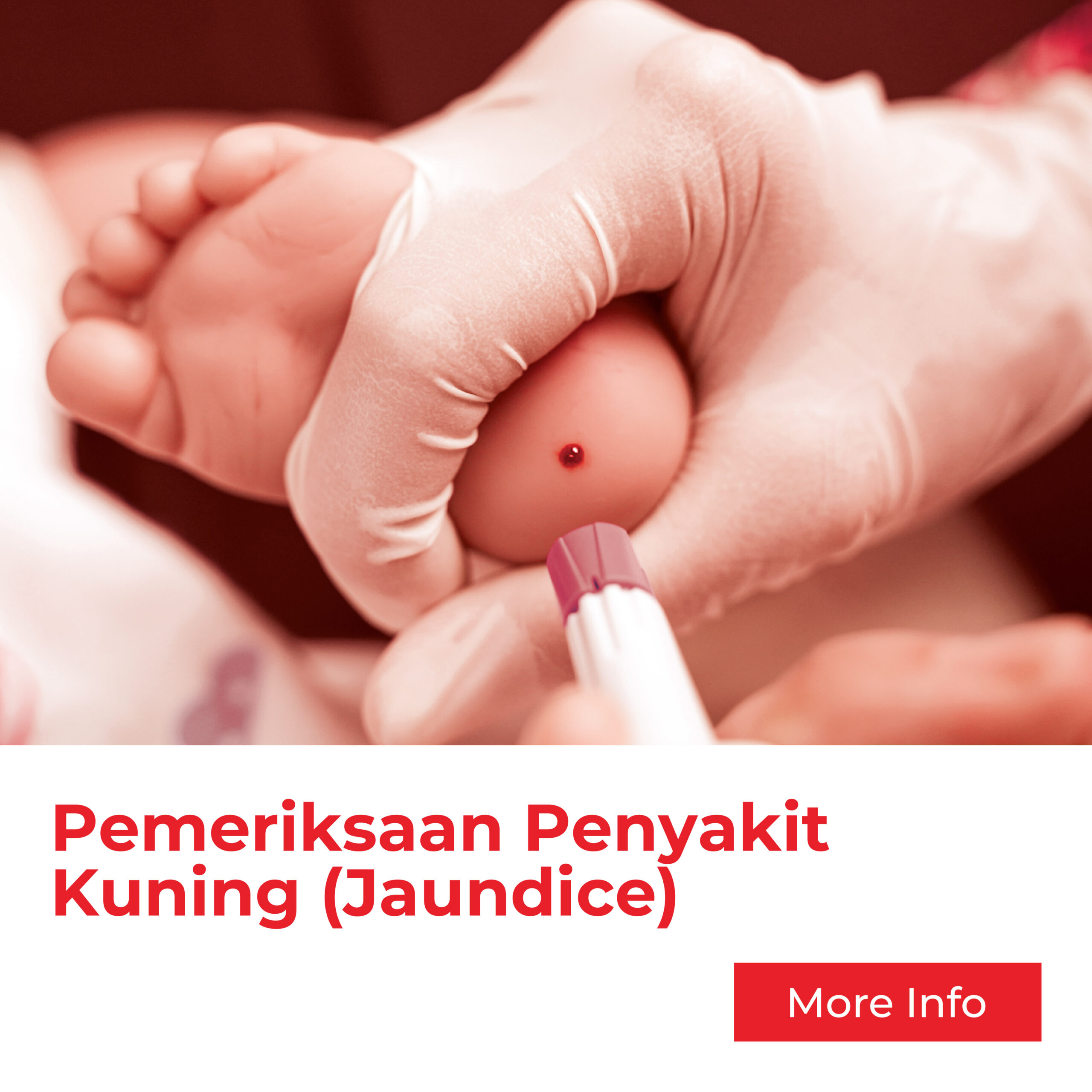 Pemeriksaan Penyakit Kuning (Jaundice) Untuk Bayi Serviks Dari Klinik As Salam