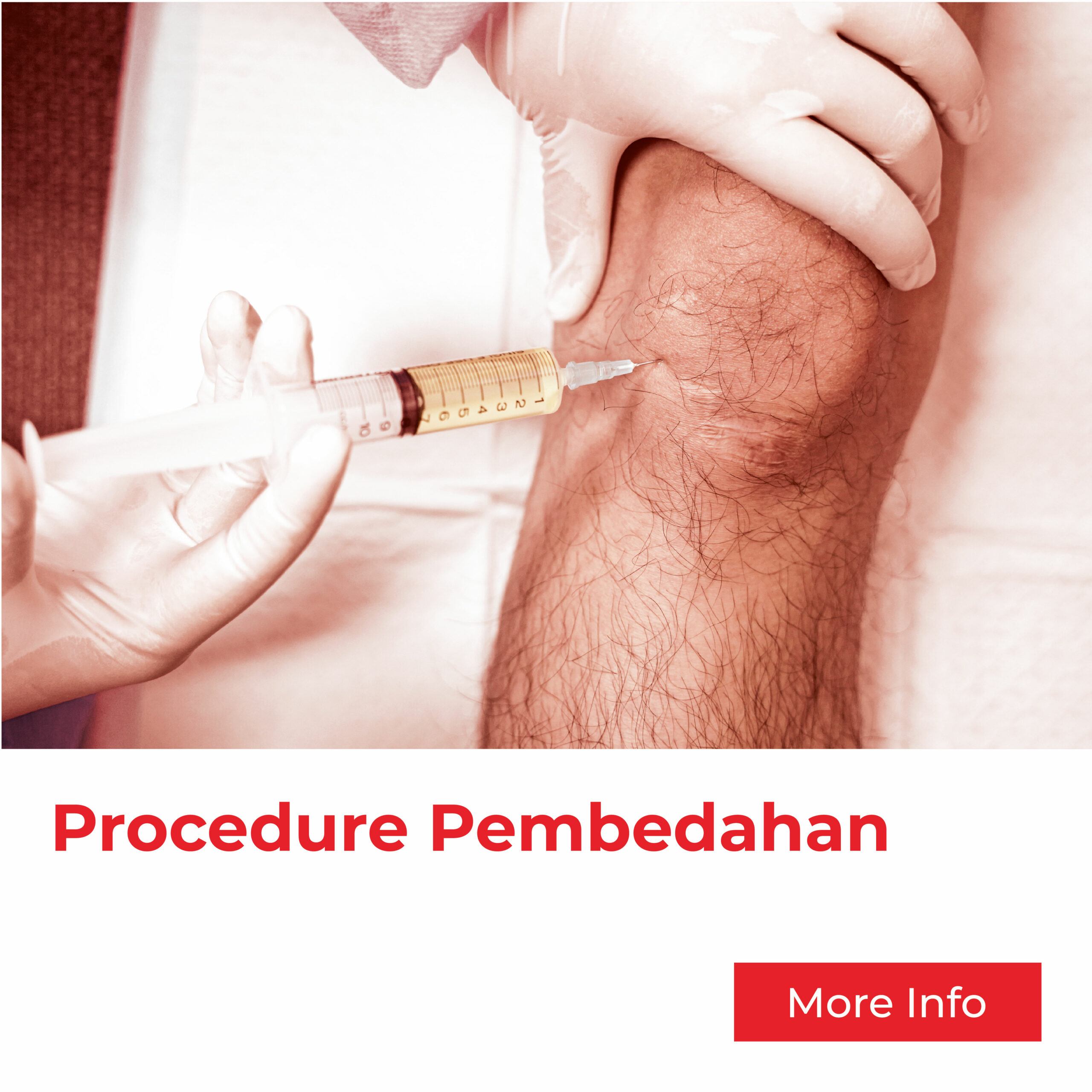 Prosedur Pembedahan & Serviks dari Klinik As Salam