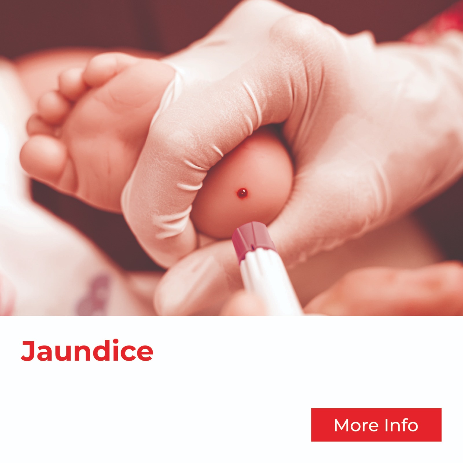 Jaundice Test/ Bilirubin Test for NewBorn from Klinik As Salam